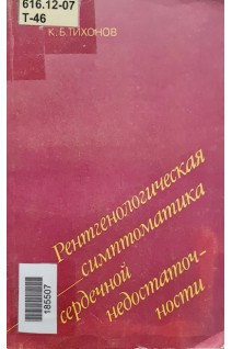 Рентгенологическая симптоматика сердечной недостаточности (БУ). Тихонов К.Б.