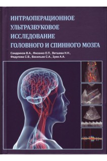 Интраоперационное ультразвуковое исследование головного и спинного мозга. Сандриков В.А. Фисенко Е.П. и соавт.