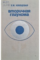 Вторичная глаукома (БУ). Клюцевая Е.И.
