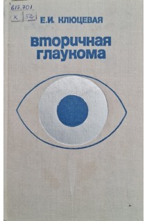 Вторичная глаукома (БУ). Клюцевая Е.И.