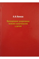 Врожденное укорочение нижних конечностей у детей. Попков А.В. Осипенко А.В.