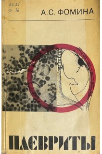 Плевриты (БУ). Фомина А.С.