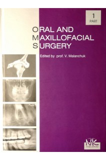 Oral and Maxillofacial Surgery (Хірургічна стоматологія та щелепно-лицева хірургія) Ч.1. Підручник . Malanchuk V.O. (Маланчук В. О. та ін.)