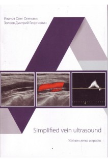 УЗИ вен: легко и просто. Simplified vein ultrasound. 1-е издание.. Иванов О.