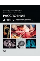 Расслоение аорты. Личные истории пациентов и достижения спасшие им жизнь. Мелиссано Дж. Киеза Р.