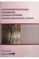 Атеросклеротические поражения сонных артерий: клиника диагностика лечение 3-е  изд. учебно-метод. Иванов Л.Н.