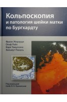 Кольпоскопия и патология шейки матки по Бургхардту. Жирарди Франк Райх Олаф Тамуссино Карл Пикель Хельмут.