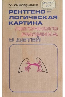 Рентгенологическая картина легоного рисунка у детей (БУ). Владыкина М.И.
