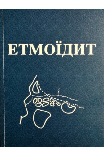 Етмоїдит. Лайко А.А. Заболотний Д.І. Косаковский А.Л.