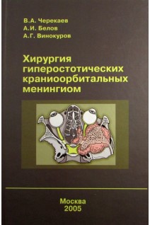 Хирургия гиперостотических краниоорбитальных менингиом. Черекаев В.А.