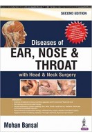 Diseases of Ear Nose and Throat. Mohan Bansal