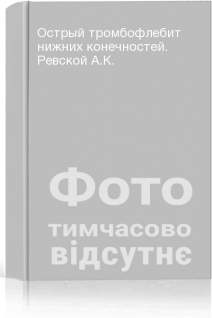 Острый тромбофлебит нижних конечностей. Ревской А.К.