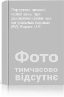 Перевязка нижней полой вены при декомпенсированных митральных пороках (БУ). Караев И.К.