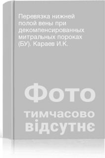 Перевязка нижней полой вены при декомпенсированных митральных пороках (БУ). Караев И.К.