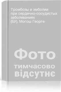 Тромбозы и эмболии при сердечно-сосудистых заболеваниях (БУ). Могош Георге