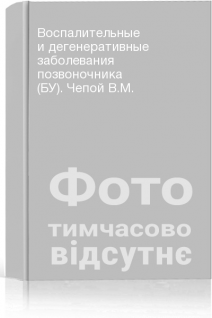 Воспалительные и дегенеративные заболевания позвоночника (БУ). Чепой В.М.
